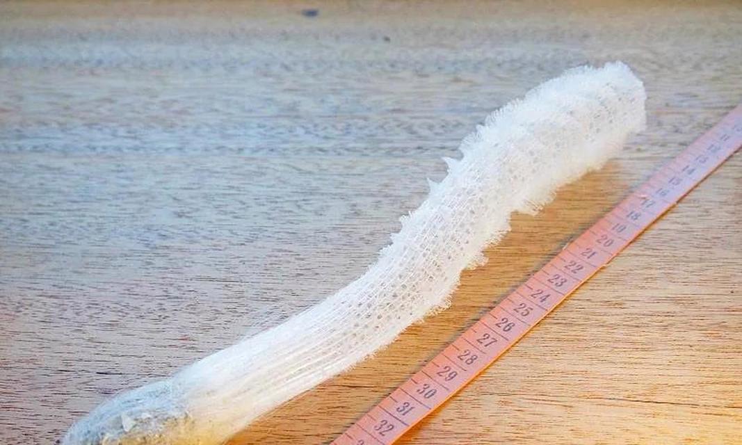 水母的死亡之谜（解析水母死亡的原因及其对生态系统的影响）